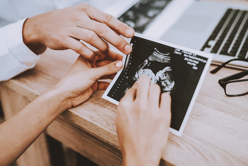 Ultrasound of baby.