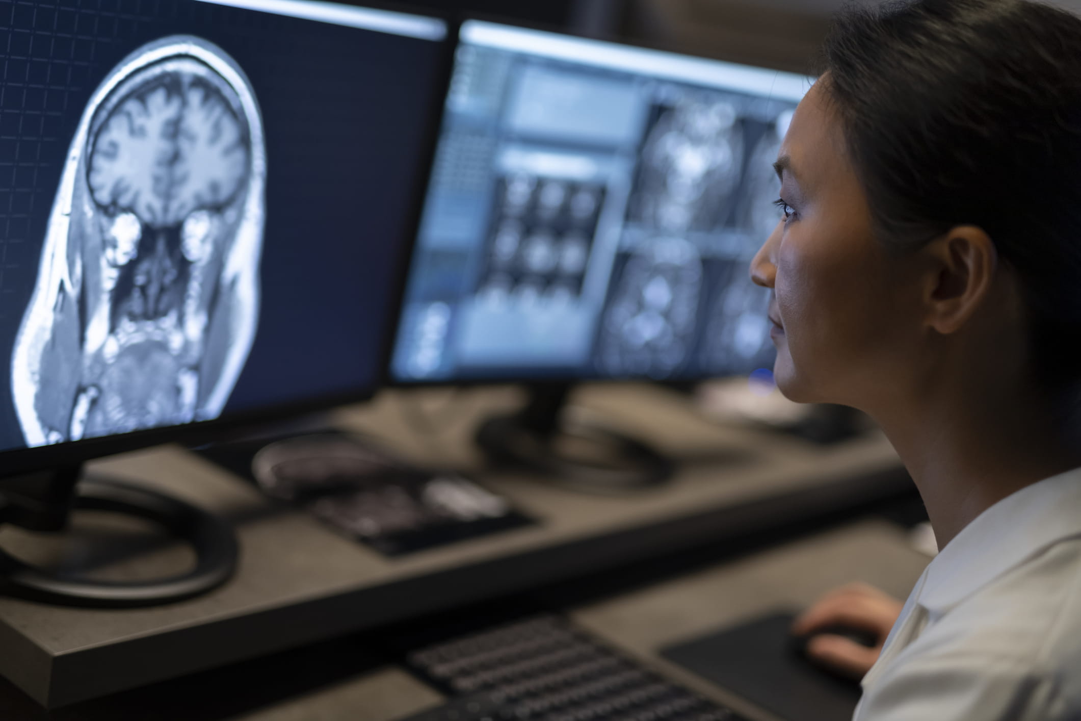 Female radiologist analysing the MRI image of the head